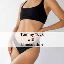 Abdominoplasty before after result Delhi — Panache Aesthetics