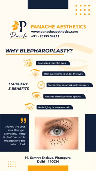 best upper eyelid blepharoplasty in delhi