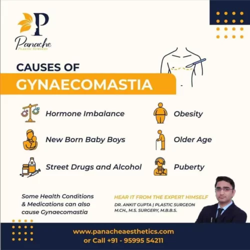 causes of gynecomastia panache aesthetics