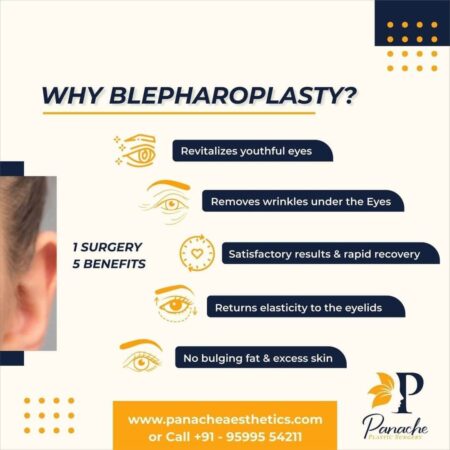 what are the benefits of blepharoplasty