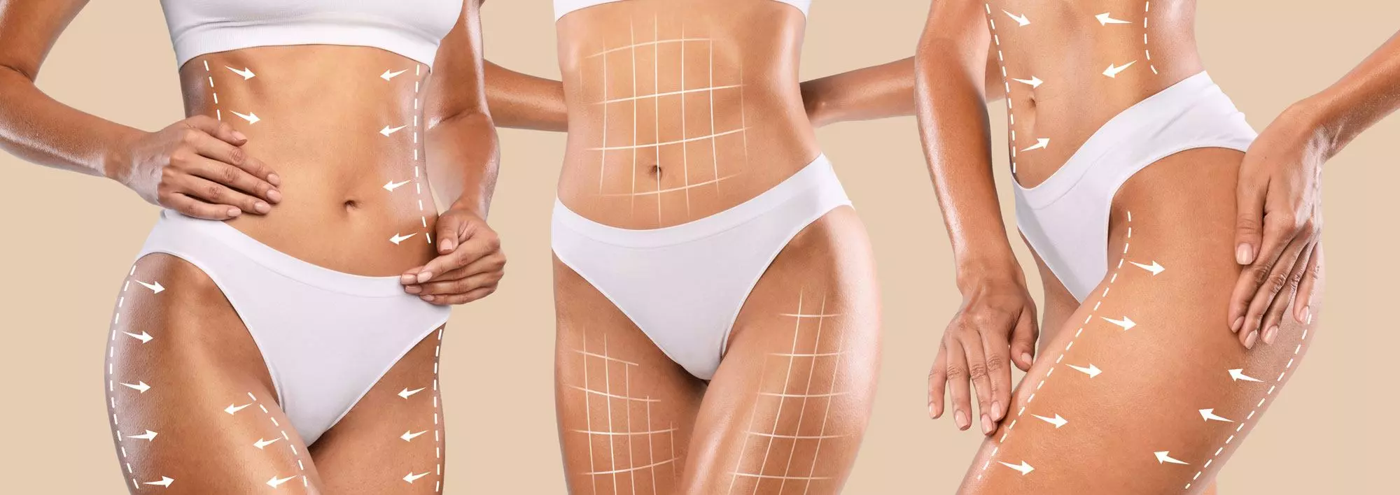 lipo16 recovery after liposuction surgery