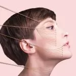 thread lift