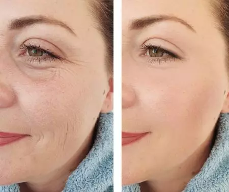 exosomes for anti ageing exosomes for anti ageing