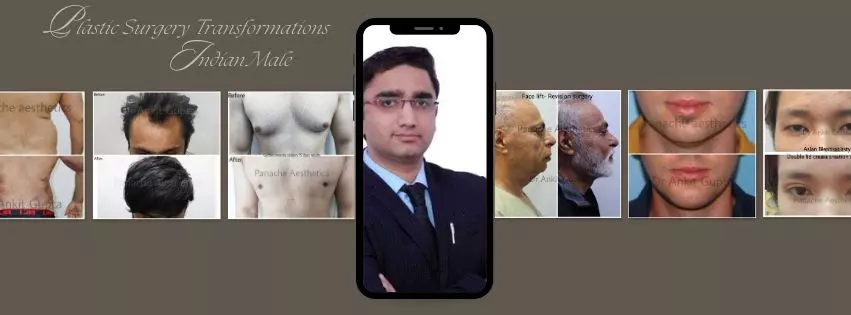 Plastic Surgery transformations indian male Plastic Surgery transformation in indian male