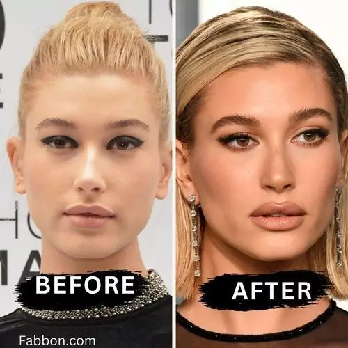 actress plastic surgery before after buccal fat removal4 actress plastic surgery before after buccal fat removal