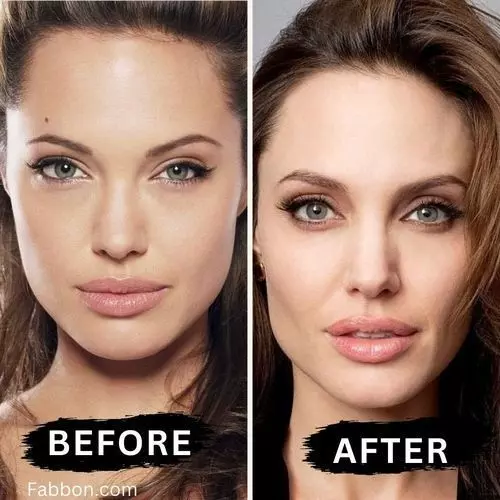 actress plastic surgery before after buccal fat removal5 actress plastic surgery before after buccal fat removal