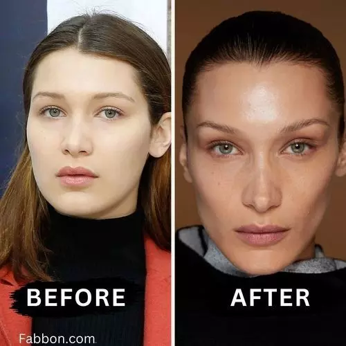 actress plastic surgery before after buccal fat removal6 actress plastic surgery before after buccal fat removal