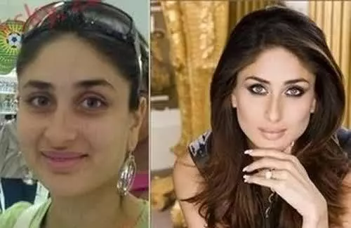 bollywood actress kareena kapoor plastic surgery actress plastic surgery before after buccal fat removal