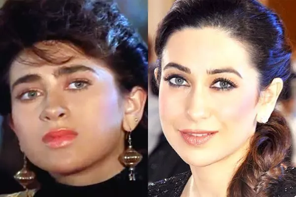 bollywood actress karisma kapoor plastic surgery actress plastic surgery before after buccal fat removal